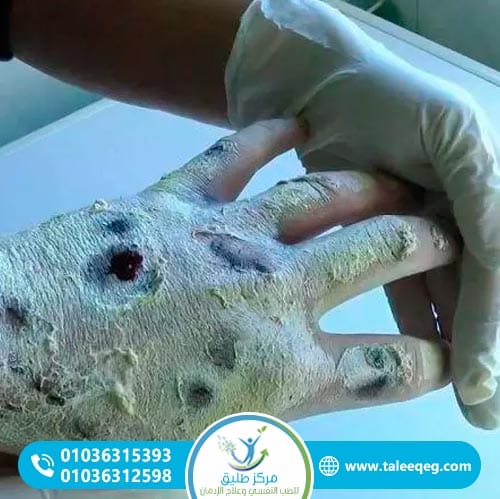 أسباب وعوامل خطر إدمان ديسومورفين