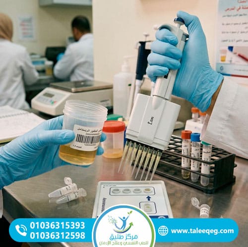مدة بقاء الترامادول في الجسم والبول والدم — ما تحتاج معرفته فعلاً 1 كيف يعمل تحليل المخدرات للكشف عن الترامادول؟