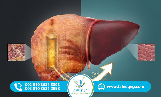 أضرار الكحول على الكبد