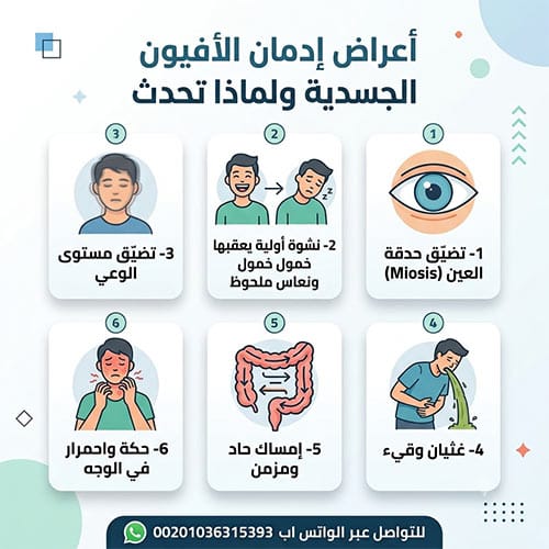 أعراض إدمان الأفيون: كيف تتعرف عليها وماذا تفعل بعد ذلك؟ 1 أعراض إدمان الأفيون الجسدية ولماذا تحدث