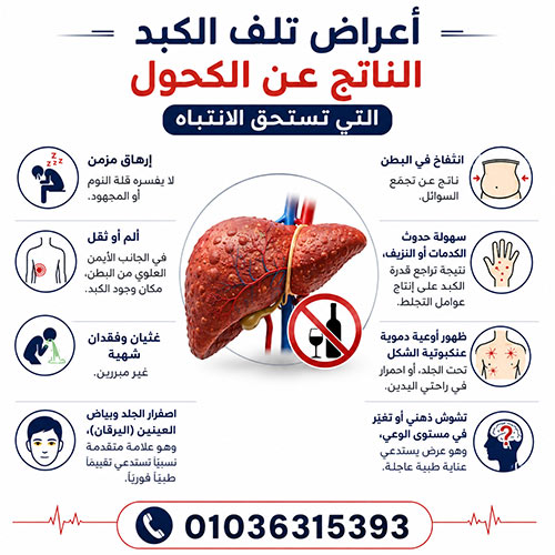 أضرار الكحول على الكبد: من الكبد الدهني إلى التليف وطريق التعافي 1 أعراض تلف الكبد الناتج عن الكحول التي تستحق الانتباه